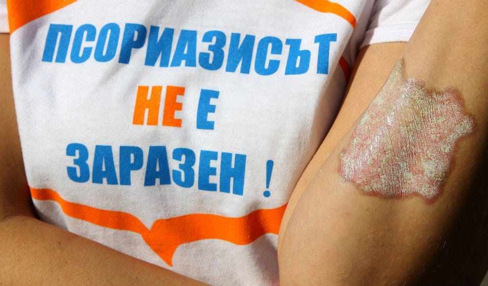 „Световен ден на хората с псориазис" — снимка 6